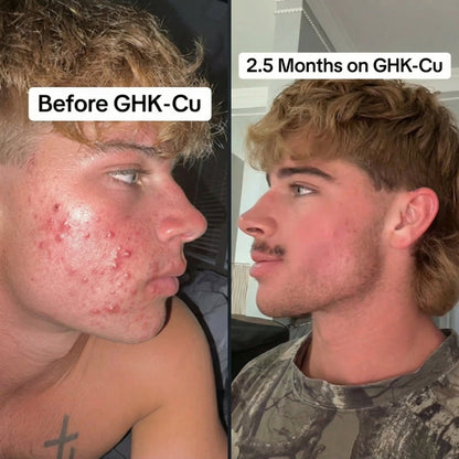 GHK-Cu Peptides Serum